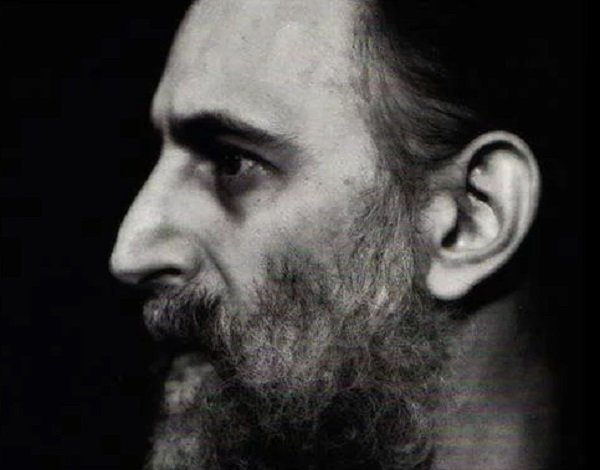 Frank Zappa il tumore alla prostata